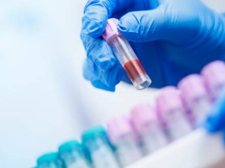 Dallas, TX DWI defense lawyer